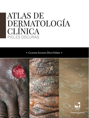 cover image of Atlas de dermatología clínica